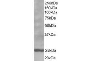 Image no. 1 for anti-B-Cell CLL/lymphoma 2 (BCL2) (N-Term) antibody (ABIN374455) (Bcl-2 anticorps  (N-Term))