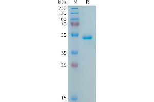 Human APRIL Protein, hFc Tag on SDS-PAGE under reducing condition.