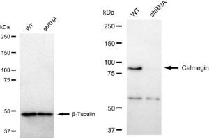 anti-Calmegin (CLGN) antibody