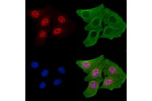 ABIN7093251 and ABIN7097268 staining H2O2 treated Hela cells by IF/ICC. (ETS1 anticorps  (pThr38))