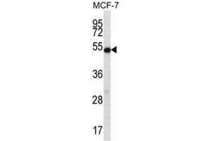 COIL Antibody (Center) western blot analysis in MCF-7 cell line lysates (35µg/lane). (Coilin anticorps  (Middle Region))