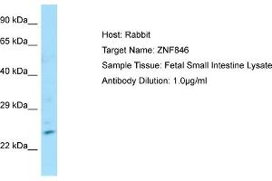 Host: Rabbit Target Name: ZNF846 Sample Type: Fetal Small Intestine lysates Antibody Dilution: 1. (ZNF846 anticorps  (N-Term))
