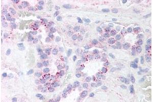 Human Kidney (formalin-fixed, paraffin-embedded) stained with RELA antibody ABIN214452 at 5 ug/ml followed by biotinylated goat anti-rabbit IgG secondary antibody ABIN481713, alkaline phosphatase-streptavidin and chromogen. (NF-kB p65 anticorps)