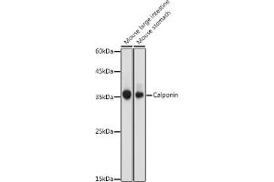 Western blot analysis of extracts of various cell lines, using Calponin antibody (ABIN7266040) at 1:1000 dilution.