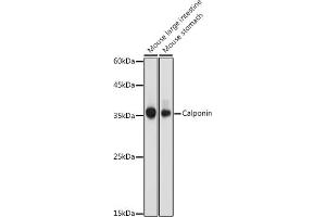 Western blot analysis of extracts of various cell lines, using Calponin antibody (ABIN7266040) at 1:1000 dilution. (CNN1 anticorps  (AA 130-180))