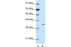 Western Blotting (WB) image for anti-Homeobox Containing 1 (HMBOX1) antibody (ABIN2461931) (HMBOX1 anticorps)