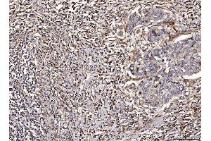 IHC analysis of ACADM/MCAD using anti-ACADM/MCAD antibody (ABIN7601543). (Medium-Chain Specific Acyl-CoA Dehydrogenase, Mitochondrial (MCAD) (AA 38-401) anticorps)