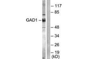 Western blot analysis of extracts from mouse brain cells, using GAD1/2 Antibody. (GAD65+GAD67 (AA 545-594) anticorps)