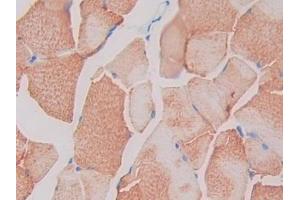 IHC-P analysis of Rat Skeletal muscle Tissue, with DAB staining. (SIGIRR anticorps  (AA 1-118))