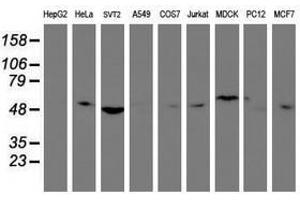 Image no. 2 for anti-Tubby Like Protein 3 (TULP3) antibody (ABIN1501586) (TULP3 anticorps)