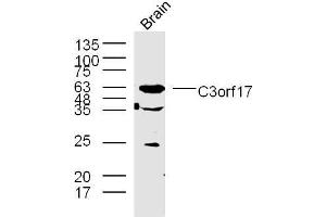 Lane 1: mouse brain lysates probed with C3orf17 Polyclonal Antibody, Unconjugated  at 1:300 overnight at 4˚C. (C3orf17 anticorps  (AA 430-480))
