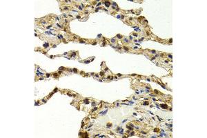 Immunohistochemistry (IHC) image for anti-Sulfotransferase Family, Cytosolic, 1A, Phenol-Preferring, Member 1 (SULT1A1) (AA 1-295) antibody (ABIN3022214)