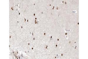 ABIN6266677 at 1/100 staining human brain tissue sections by IHC-P.