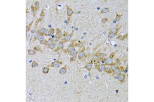 Immunohistochemistry of paraffin-embedded mouse brain using EIF2AK4 antibody. (GCN2 anticorps)