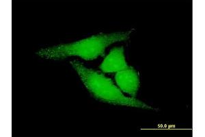 Immunofluorescence of purified MaxPab antibody to LOC81691 on HeLa cell. (LOC81691 anticorps  (AA 1-774))