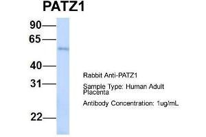 Host:  Rabbit  Target Name:  PATZ1  Sample Type:  Human Adult Placenta  Antibody Dilution:  1. (PATZ1 anticorps  (N-Term))