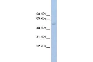WB Suggested Anti-ANKRD13D Antibody Titration: 0. (ANKRD13D anticorps  (Middle Region))