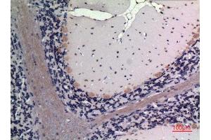 Immunohistochemistry (IHC) analysis of paraffin-embedded Rat Brain, antibody was diluted at 1:100.
