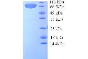 SDS-PAGE (SDS) image for Calpastatin (ICAL) (AA 1-667), (partial) protein (His tag) (ABIN5713314) (Calpastatin Protein (ICAL) (AA 1-667, partial) (His tag))