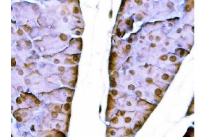IHC analysis of Sox11 using anti-Sox11 antibody (ABIN7599308).