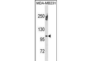 EN Antibody (N-term) (ABIN1881296 and ABIN2838757) western blot analysis in MDA-M cell line lysates (35 μg/lane). (ENPP1 anticorps  (N-Term))