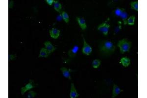 Immunofluorescence staining of SH-SY5Y cells with ABIN7175604 at 1:50, counter-stained with DAPI. (CACNA1B anticorps  (AA 2132-2339))