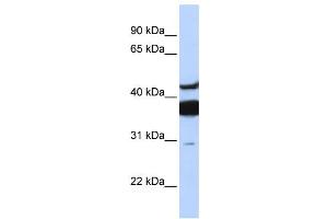 Western Blotting (WB) image for anti-Ceramide Synthase 2 (CERS2) antibody (ABIN2457964) (Ceramide Synthase 2 anticorps)