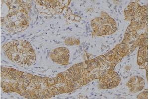 ABIN6273644 at 1/100 staining Human uterus tissue by IHC-P.