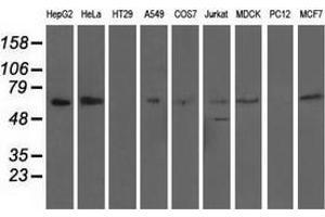 Western blot analysis of extracts (35 µg) from 9 different cell lines by using anti-AFP monoclonal antibody. (alpha Fetoprotein anticorps)