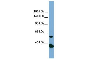 Host:  Rabbit  Target Name:  RAD50  Sample Type:  PANC1 Whole Cell lysates  Antibody Dilution:  1. (RAD50 anticorps  (N-Term))