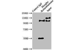 Immunoprecipitating Phospho-RB1 in Hela whole cell lysate Lane 1: Rabbit control IgG(1 μg)instead of ABIN7127740 in Hela whole cell lysate. (Recombinant Retinoblastoma 1 anticorps  (pSer780))