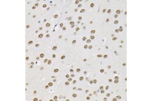 Immunohistochemistry of paraffin-embedded mouse brain using Smarcd1 antibody (ABIN6132669, ABIN6137420, ABIN6137421 and ABIN6225284) at dilution of 1:100 (40x lens).