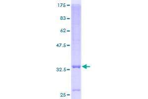 Image no. 1 for Solute Carrier Family 39 (Zinc Transporter), Member 3 (SLC39A3) (AA 1-105) protein (GST tag) (ABIN1320430)