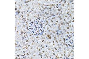 Immunohistochemistry of paraffin-embedded mouse kidney using ILK Antibody. (ILK anticorps  (AA 1-260))