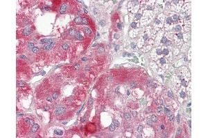 Human Adrenal: Formalin-Fixed, Paraffin-Embedded (FFPE)