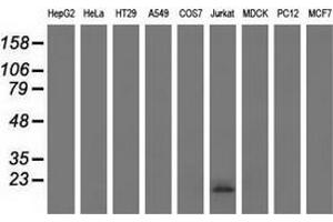 Western blot analysis of extracts (35 µg) from 9 different cell lines by using anti-EFNA2 monoclonal antibody. (Ephrin A2 anticorps)