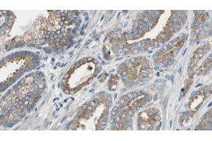 ABIN6277635 at 1/100 staining Human prostate tissue by IHC-P. (PNMT anticorps  (N-Term))