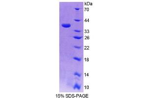 SDS-PAGE analysis of Rat S17aH Protein. (CYP17A1 Protéine)
