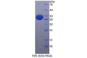 SDS-PAGE analysis of Mouse Integrin alpha E Protein. (CD103 Protéine)