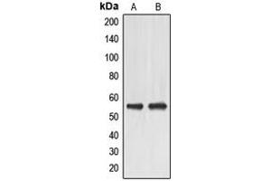 Western blot analysis of EMR4 expression in HeLa (A), HuvEc (B) whole cell lysates. (EMR4 anticorps  (Center))
