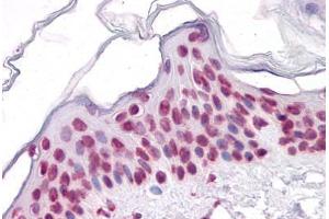 Human Skin: Formalin-Fixed, Paraffin-Embedded (FFPE) (SIRT1 anticorps  (AA 456-555))
