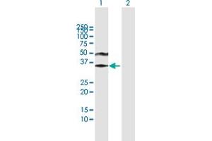 Western Blot analysis of ACRV1 expression in transfected 293T cell line by ACRV1 MaxPab polyclonal antibody. (ACRV1 anticorps  (AA 1-265))