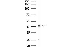 Western blot analysis of lysates from Hela cells(heat-shock,45 min treatment), using HS Antibody at 1/1000 dilution.