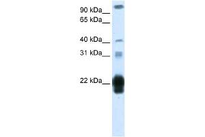 WB Suggested Anti-CSH1 Antibody Titration:  1. (CSH1 anticorps  (Middle Region))