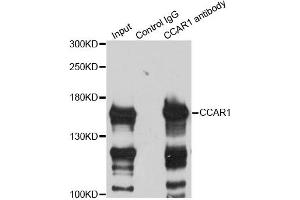 Immunoprecipitation analysis of 200ug extracts of HeLa cells using 3ug CCAR1 antibody (ABIN6291285). (CCAR1 anticorps)