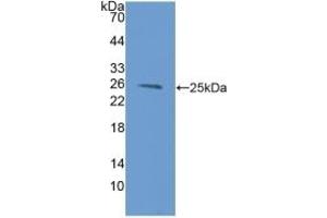 Detection of Recombinant LMP2, Mouse using Polyclonal Antibody to Proteasome subunit beta type-9 (PSMB9)