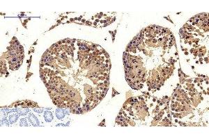 Immunohistochemistry of paraffin-embedded Mouse testis tissue using MICU1 Monoclonal Antibody at dilution of 1:200. (MICU1 anticorps)