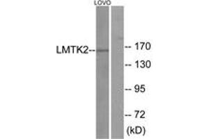 Western blot analysis of extracts from LOVO cells, using LMTK2 Antibody. (LMTK2 anticorps  (AA 651-700))
