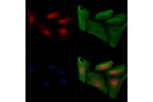 ABIN6255286 and ABIN6267647 staining  cells(H2O2 treatment) by IF/ICC. (IRF3 anticorps  (pSer386))
