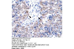 Human Liver (HIV-1 Tat Interactive Protein 2, 30kDa (HTATIP2) (N-Term) anticorps)